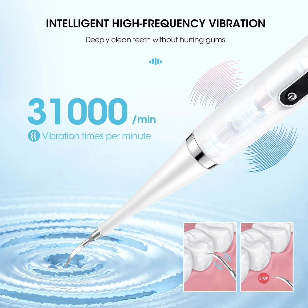 Whitening Calculus Scaler
